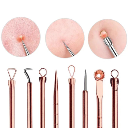 4Pcs Blackhead Remover Tool Set Ultra Fine Pore Extractor Needles Facial Acne Blemish Whiteheads Cleansing Beauty Kit
