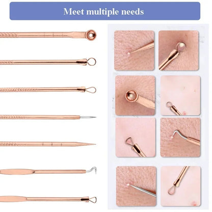 4Pcs Blackhead Remover Tool Set Ultra Fine Pore Extractor Needles Facial Acne Blemish Whiteheads Cleansing Beauty Kit