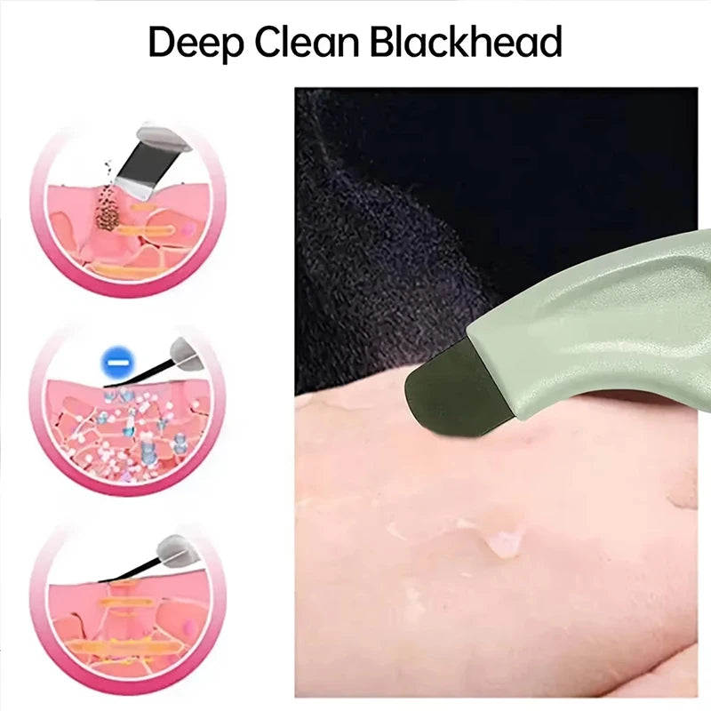 Deep Cleansing Blackhead and Whitehead Removal Tool for Nose and Face - Skin Pore Cleaner Skin Care Beauty Tools Hot Sale
