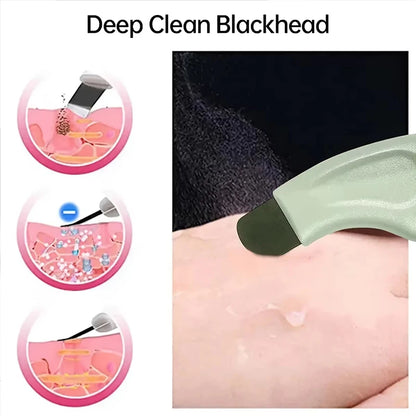 Deep Cleansing Blackhead and Whitehead Removal Tool for Nose and Face - Skin Pore Cleaner Skin Care Beauty Tools Hot Sale